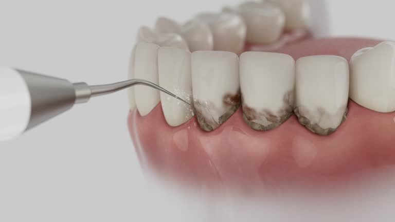 Trusted Dental Implants service in Temescal Valley, CA - Dentist Open Now